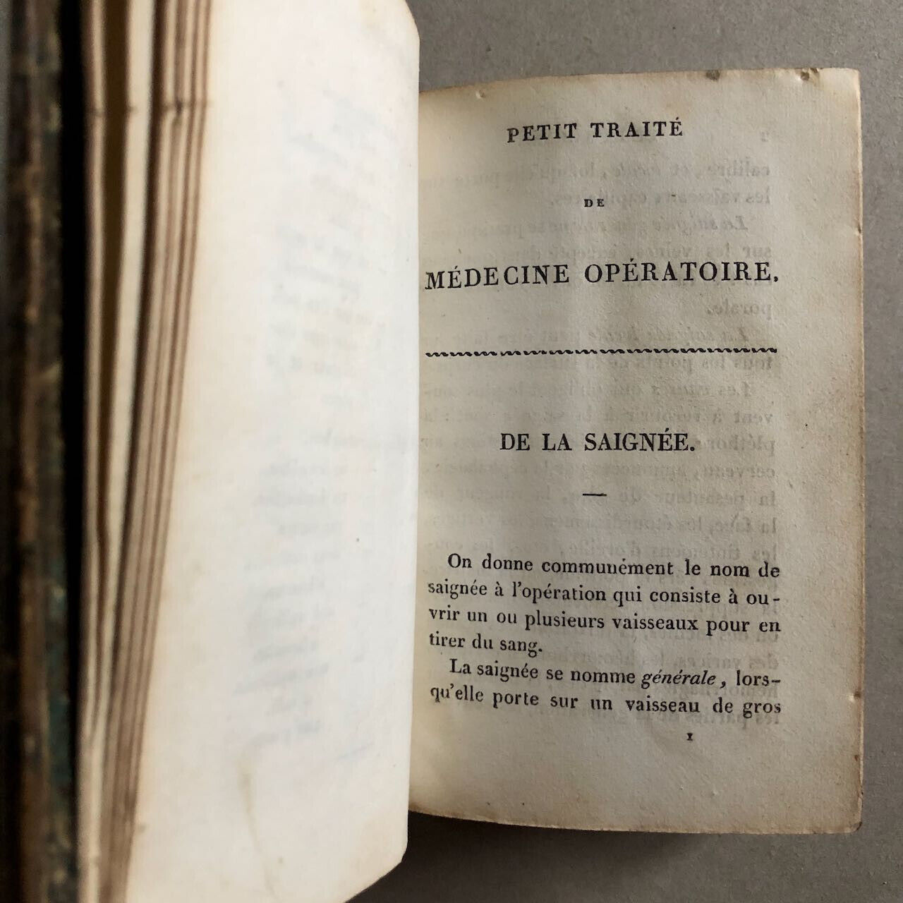 Jules Hatin — Médecine opératoire — 3 pl. dépliantes — Baillière — 1837.